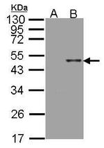Arylsulfatase B Polyclonal Antibody