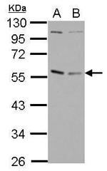 GABPA Polyclonal Antibody