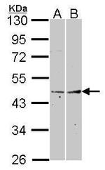 Fibromodulin Polyclonal Antibody