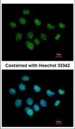 XPC Polyclonal Antibody