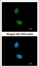 ZNF134 Polyclonal Antibody