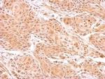 ZNF134 Antibody in Immunohistochemistry (Paraffin) (IHC (P))