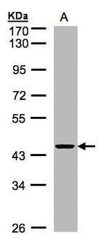 ZNF134 Antibody in Western Blot (WB)