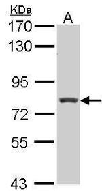 RFX3 Polyclonal Antibody