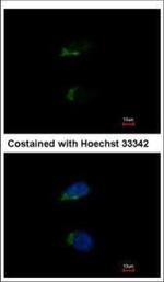 JIK Polyclonal Antibody