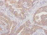 PKC lambda/iota Antibody in Immunohistochemistry (Paraffin) (IHC (P))