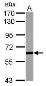 FGR Antibody in Western Blot (WB)