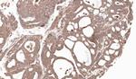 MMP12 Polyclonal Antibody