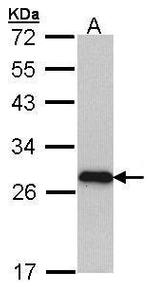 MYL3 Antibody in Western Blot (WB)