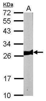 MYL3 Polyclonal Antibody