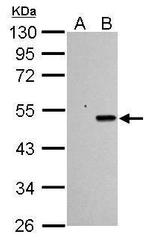 p53 Antibody in Western Blot (WB)