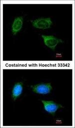 ATP Synthase B1 Polyclonal Antibody