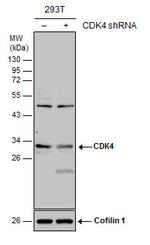 CDK4 Antibody in Western Blot (WB)