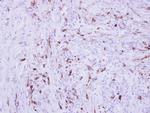 Collagen III Polyclonal Antibody