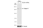 Collagen III Antibody in Western Blot (WB)