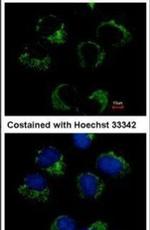 CAT1 Antibody in Immunocytochemistry (ICC/IF)