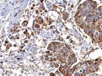 SERPINH1 Antibody in Immunohistochemistry (Paraffin) (IHC (P))
