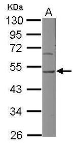 SERPINH1 Antibody in Western Blot (WB)