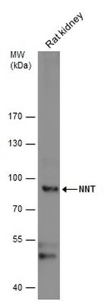 NNT Antibody in Western Blot (WB)