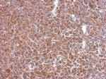 STIP1 Antibody in Immunohistochemistry (Paraffin) (IHC (P))