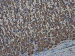 GLMN Antibody in Immunohistochemistry (Paraffin) (IHC (P))