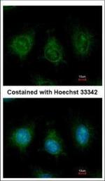 DAK Polyclonal Antibody