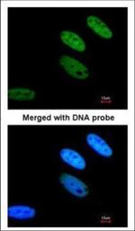 TAF15 Polyclonal Antibody