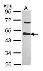 USP18 Antibody in Western Blot (WB)