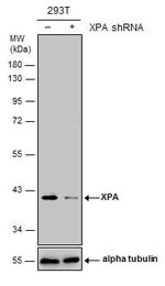 XPA Antibody in Western Blot (WB)