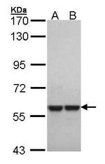 MUTYH Antibody in Western Blot (WB)