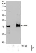 SERPINB2 Antibody in Immunoprecipitation (IP)