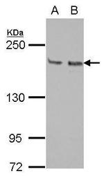 KIF14 Polyclonal Antibody