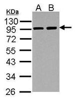alpha Actinin 3 Polyclonal Antibody