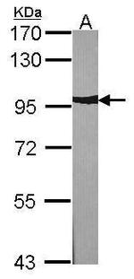 alpha Actinin 2 Antibody in Western Blot (WB)