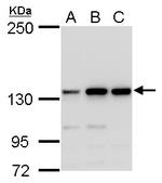 MSH3 Polyclonal Antibody