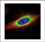 GRP94 Polyclonal Antibody