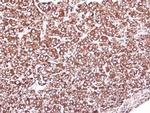 GRP94 Antibody in Immunohistochemistry (Paraffin) (IHC (P))