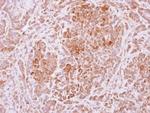 USP4 Polyclonal Antibody