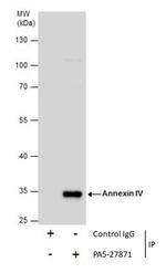 Annexin A4 Antibody in Immunoprecipitation (IP)