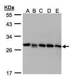 D4-GDI Polyclonal Antibody