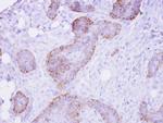 FRS2 Antibody in Immunohistochemistry (Paraffin) (IHC (P))