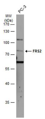 FRS2 Antibody in Western Blot (WB)
