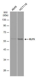 KLF5 Antibody in Western Blot (WB)
