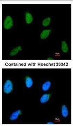 RAD54B Polyclonal Antibody