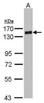 PHF20 Polyclonal Antibody