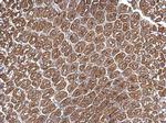 Arp2 Antibody in Immunohistochemistry (Paraffin) (IHC (P))