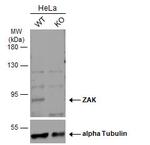 ZAK Polyclonal Antibody