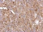 Annexin A3 Polyclonal Antibody