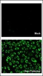 Dengue Virus Type 2 NS4B Antibody in Immunocytochemistry (ICC/IF)