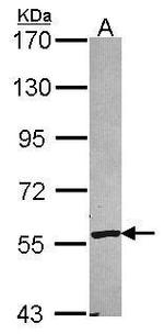 CYP2A6 Polyclonal Antibody